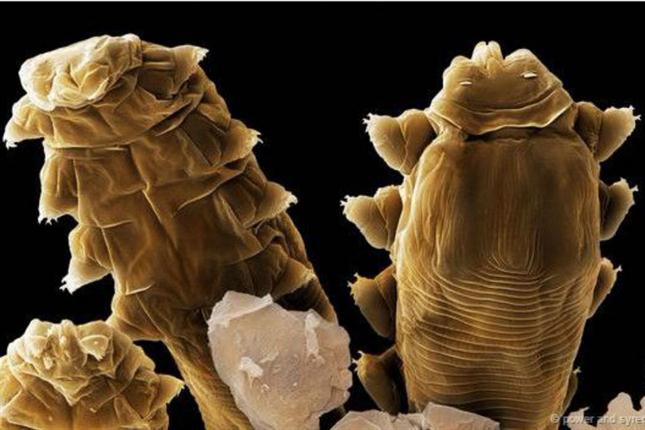 ¿De qué sirve guardar los peluches en el congelador? - acaros-2