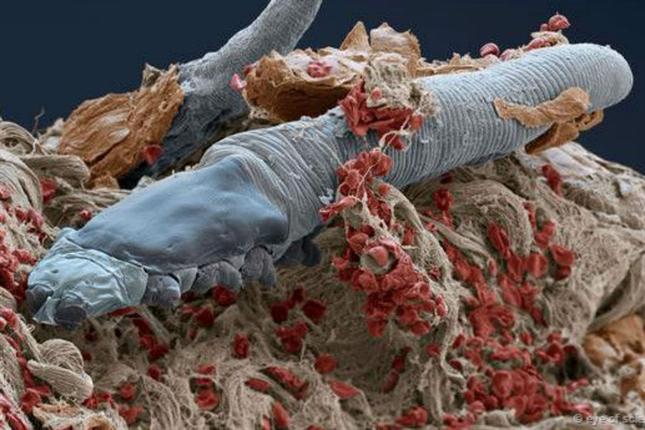 ¿De qué sirve guardar los peluches en el congelador? - acaros