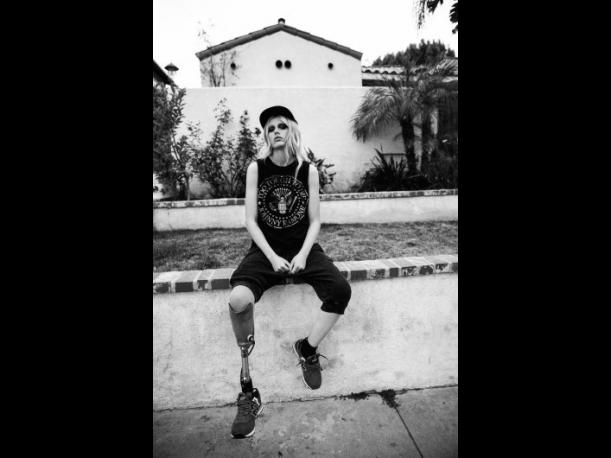 Modelo pierde pierna por infección por tampón - estados-unidos