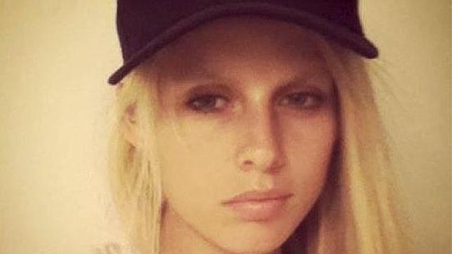 Modelo pierde pierna por infección por tampón - lauren-wasser_xoptimizadax-644x362