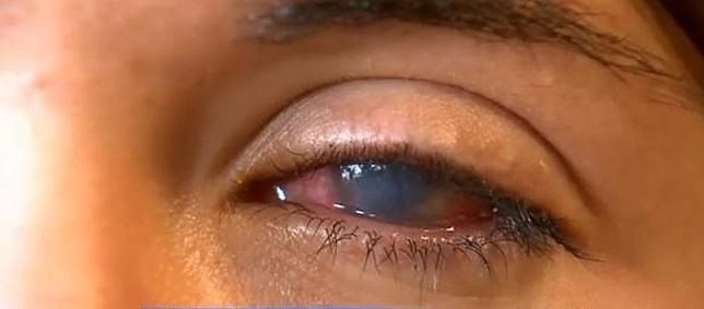 Bacteria en el lodo deja ciega a mujer - mud-run-644x362