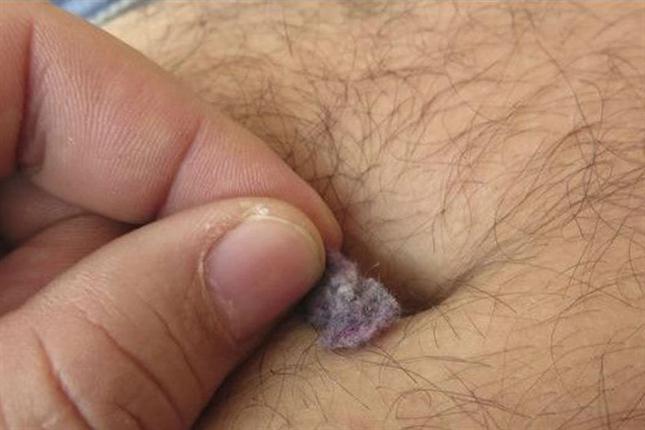 Lo que hay en tu ombligo - 2064623w645