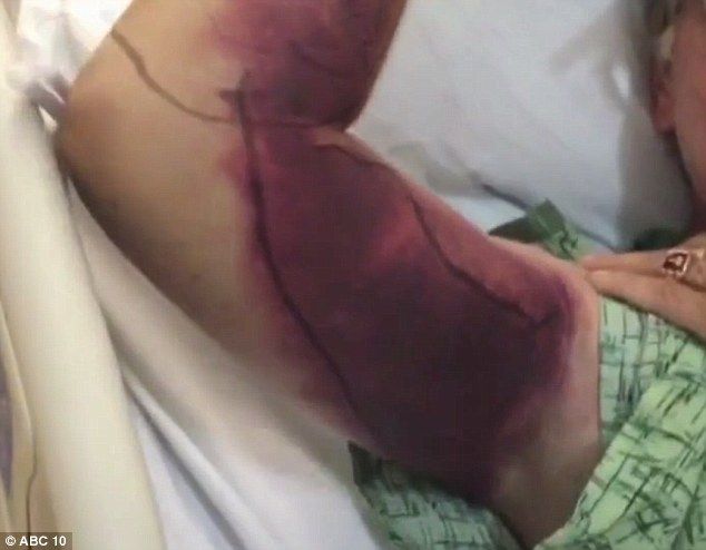 Selfie cuesta más de 2 mdp y casi la vida a un hombre - selfie_vibora