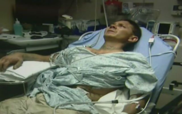 Acabó en el hospital por intentar selfie con serpiente - snake1