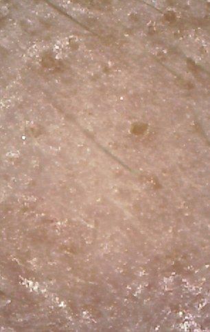 Los efectos de consumir comida rápida por una semana - comida_rapida_piel2