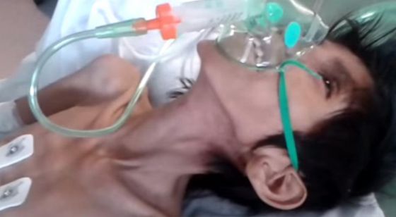 Muere niño argentino de desnutrición. Pesaba 10 kilos y tenía 14 años - foto-niño