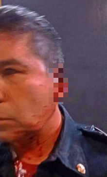 Joven muerde a policía y le arranca la oreja - unnamed